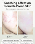 Celimax Heartleaf BHA Peeling Pad 60ea - WowDrops