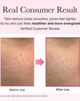 Arencia PDRN Booster Shot 30ml | Rosy-PDRN & Peptides or Glowy, Healthy Skin