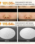 Dr.Melaxin Peel Shot Exfoliating Kojic Acid Turmeric Serum 80ml