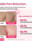 Dr.Melaxin Cemenrete Cyano Pink Spicule Serum 30ml