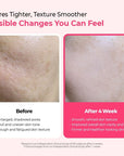 Dr.Melaxin Cemenrete Cyano Pink Spicule Serum 30ml