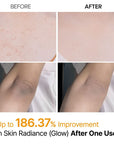 Dr.Melaxin Peel Shot Exfoliating Kojic Acid Turmeric Spray 200ml