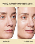 Rejuran Dual Effect Ampule 30ml
