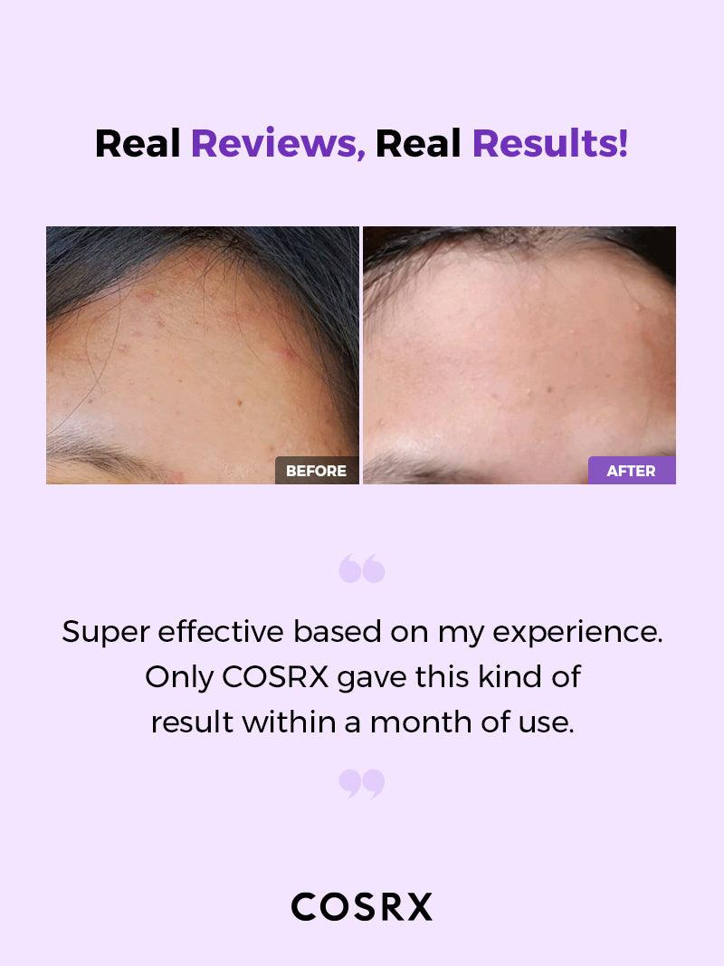 تونر معالج منقي AHA/BHA من COSRX 150 مل