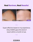 COSRX AHA/BHA Clarifying Treatment Toner 150ml