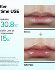 Anua PDRN Lip Serum 10ml