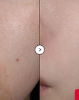 EQQUALBERRY Vitamin Illuminating Serum 30ml | Dark Spot Care
