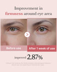 Medicube PDRN Pink Peptide Eye Cream 30ml