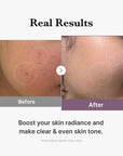 Medicube Age-R Glutathione Glow Toner 140ml