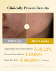 Medicube Kojic Acid Turmeric Pads 70pcs | Dark Spot & Texture Care