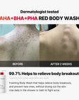 Medicube Red Acne Body Wash 2.0 400g