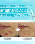 Numbuzin No.1 Pantothenic B5 Active Soothing Serum 50ml