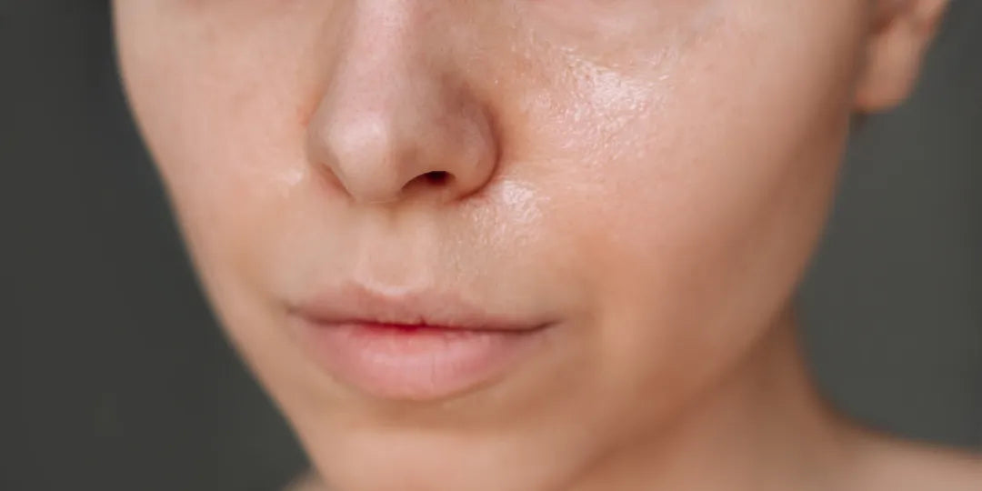 Best Korean Skincare Routine for Oily Skin in UAE’s Summer