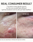 Arencia Eraser Shot Glycolic Acid Booster 30ml | Smoother, Clear-Looking Skin