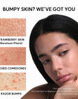 Arencia Eraser Shot Glycolic Acid Booster 30ml | Smoother, Clear-Looking Skin