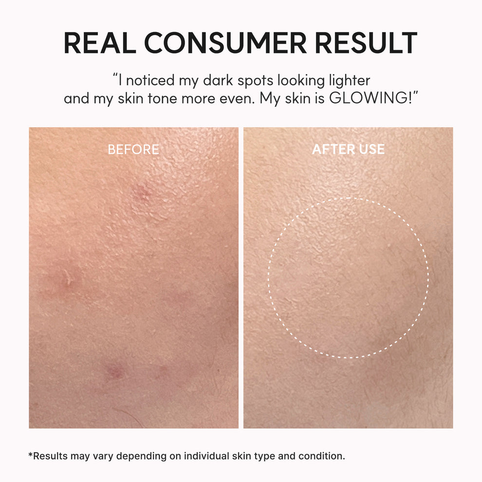 Arencia TXA Booster Shot 30ml | Dark Spot Correcting Serum