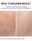 Arencia TXA Booster Shot 30ml | Dark Spot Correcting Serum
