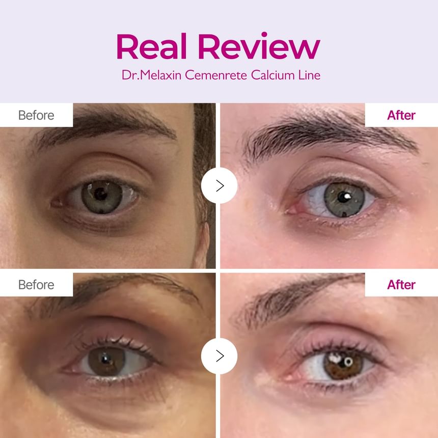 Dr.Melaxin Cemenrete Calcium Intense Cream 50ml