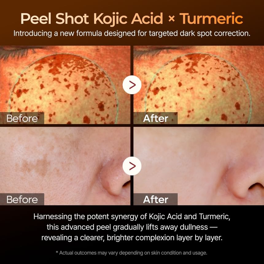 Dr.Melaxin Peel Shot Exfoliating Kojic Acid Turmeric Serum 80ml