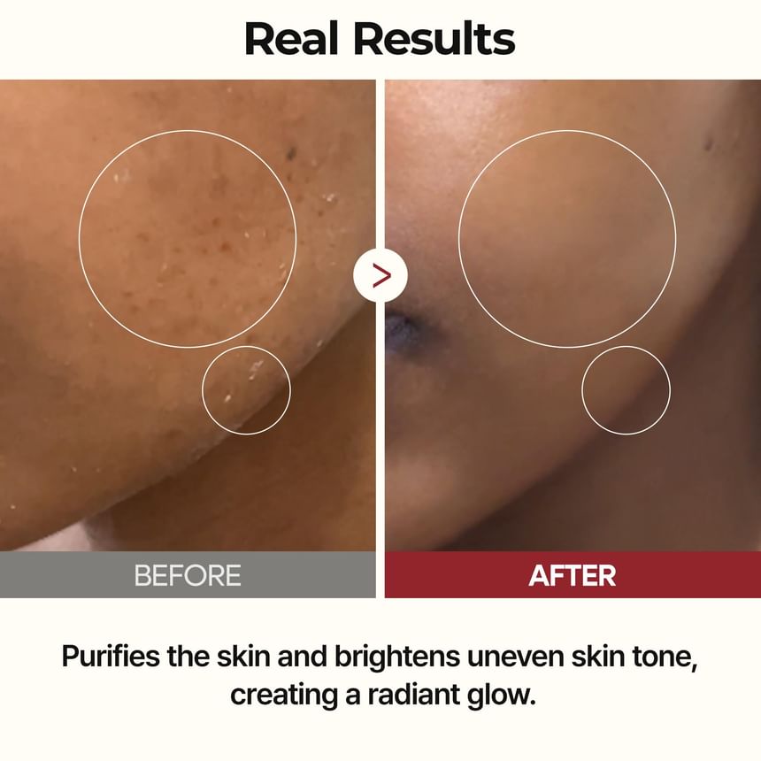 Dr.Melaxin Peel Shot Glow White Rice Toner 200ml