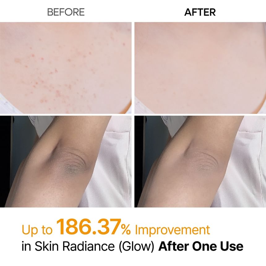 Dr.Melaxin Peel Shot Exfoliating Kojic Acid Turmeric Spray 200ml