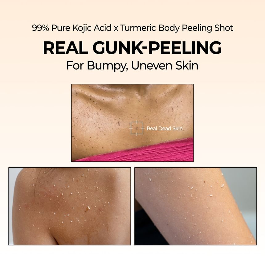 Dr.Melaxin Peel Shot Exfoliating Kojic Acid Turmeric Spray 200ml