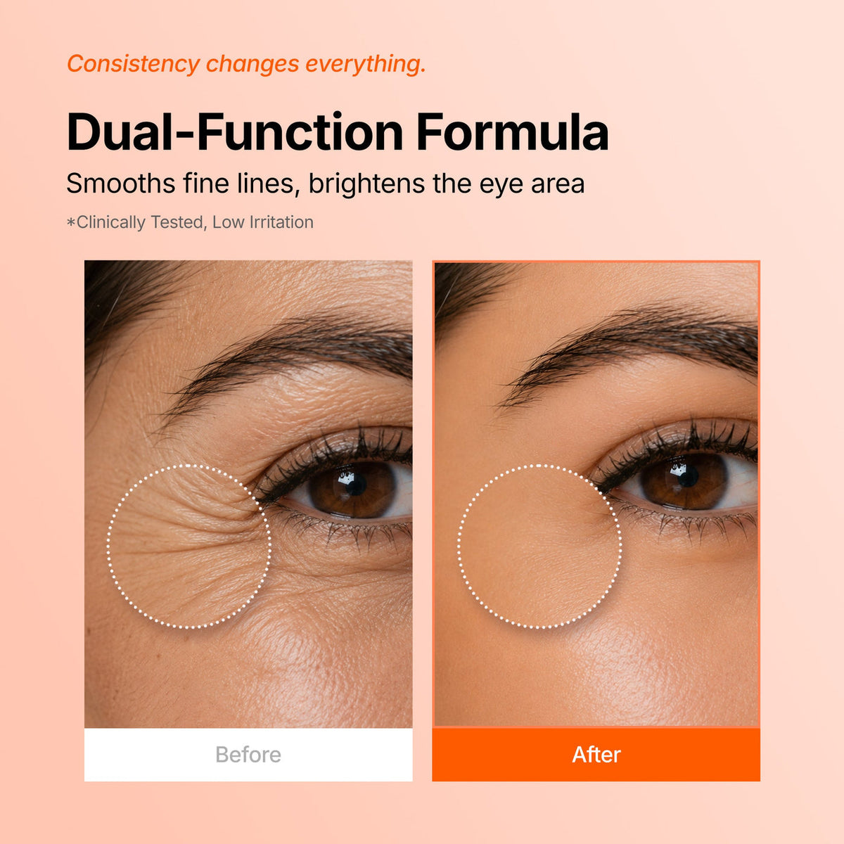 Genabelle PDRN 360 Rejuvenating Eye Mask [70 patches]