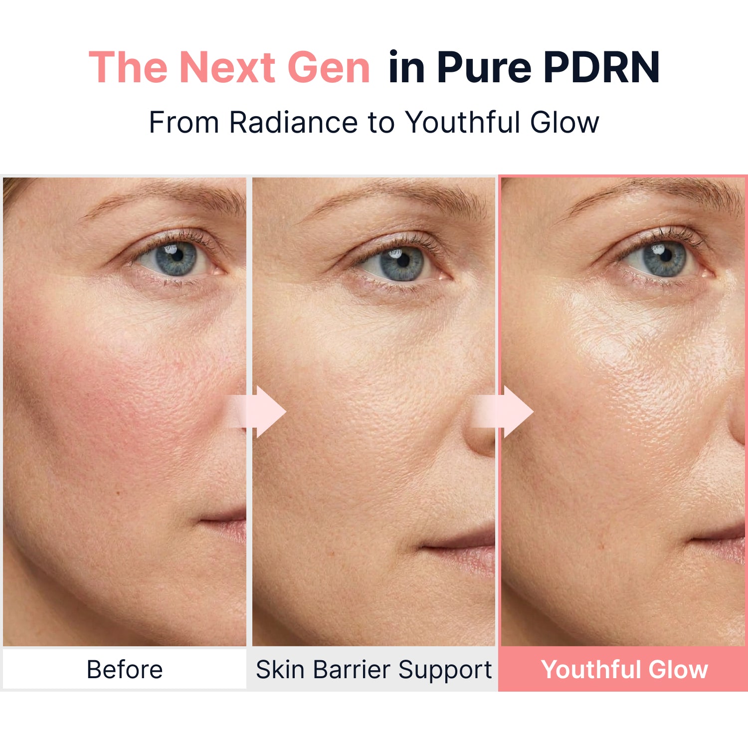 Sungboon Editor PDRN Pink Vitamin Glow Boosting Ampoule 40ml