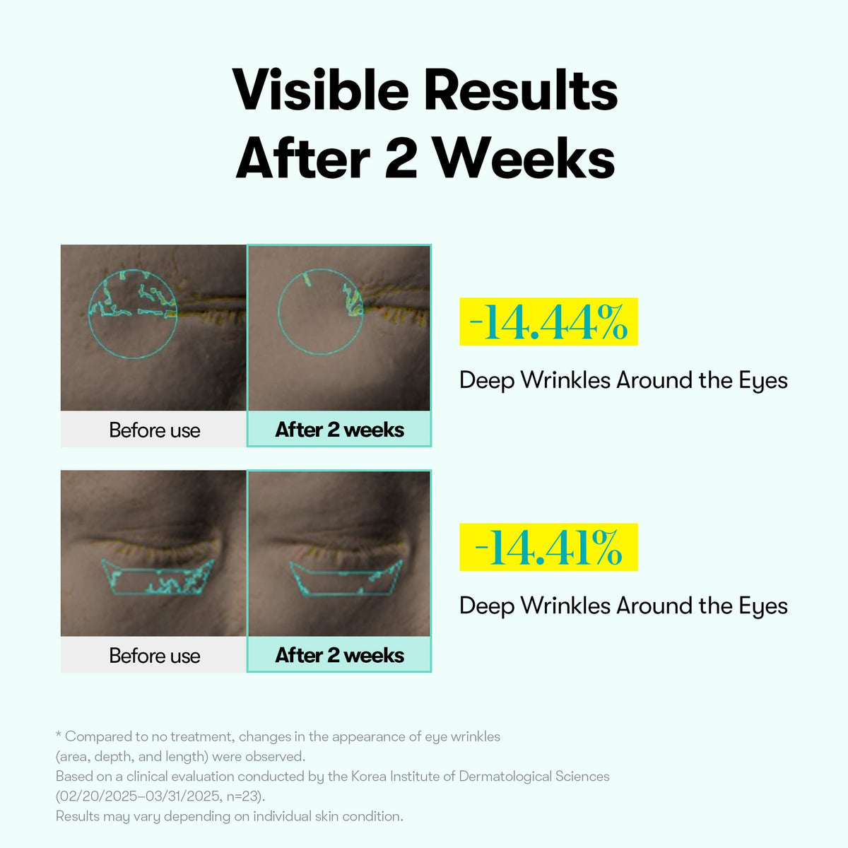 VT Cosmetics PDRN Reedle Shot Eye Lifter 15ml