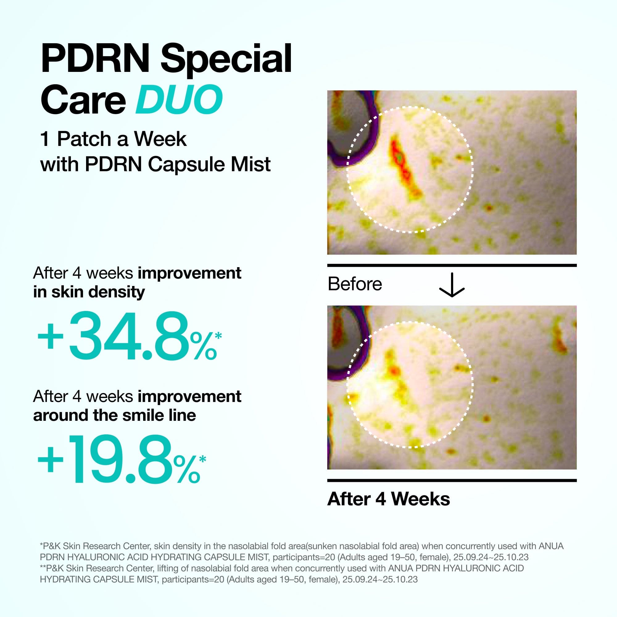 Anua PDRN Collagen Melting Patch For Glass Skin [4 patches]