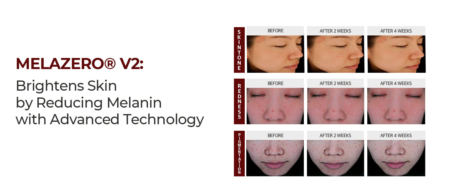 Kopher Curepair Solution Cream 50ml