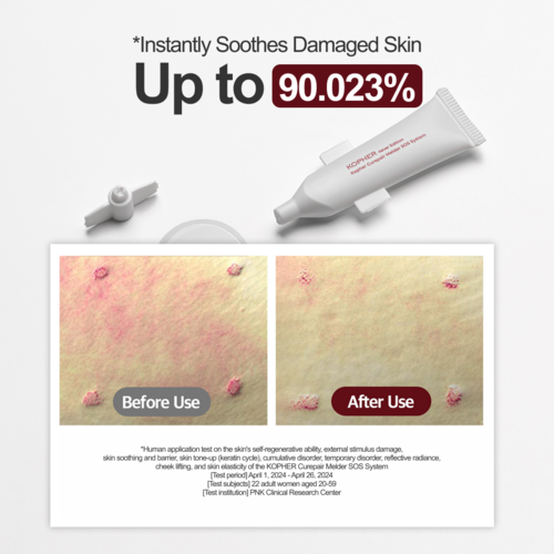 Kopher Curepair Melder SOS System 1.5ml x 20ea