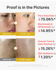 Medicube Kojic Acid Turmeric Peel Shot 80ml