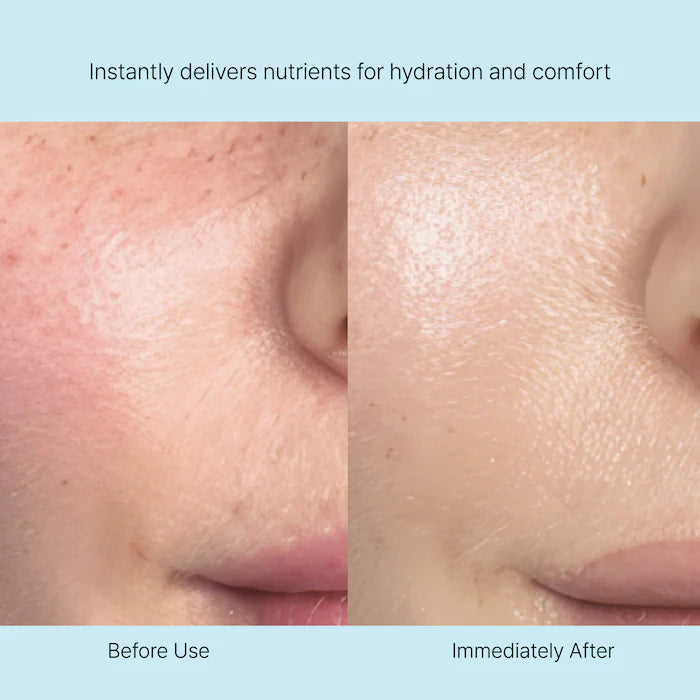Rejuran Nutritive Cream 50ml