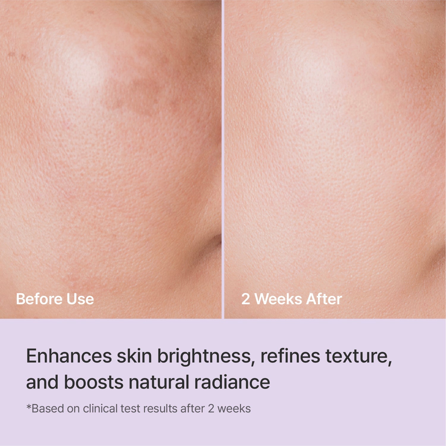 Rejuran Triple Radiance Ampoule 30ml