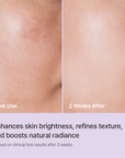 Rejuran Triple Radiance Ampoule 30ml