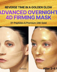 Sungboon Editor Silk Peptide EGF Gold Mask (Set of 4)
